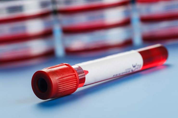Processes of PRP Preparation