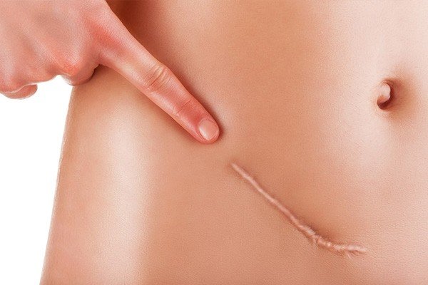 Skin Injury or Damage Causes Scars Image - PRP